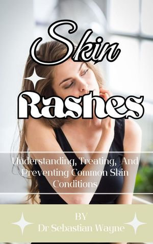 Skin Rashes EBook By Sebastian Wayne Understanding Treatment And