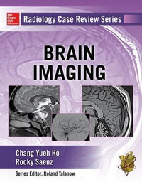 Brain Imaging 1st edition : Radiology Case Review Series - Chang Ho