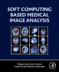 Soft Computing Based Medical Image Analysis - Dey