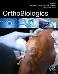 OrthoBiologics - Frank