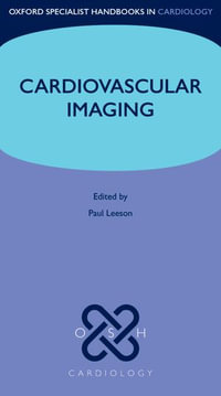 Cardiovascular Imaging : Oxford Specialist Handbooks in Cardiology - Paul Leeson