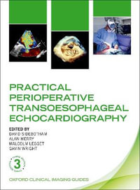 Practical Perioperative Transoesophageal Echocardiography : Oxford Clinical Imaging Guides - David Sidebotham