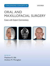 Challenging Concepts in Oral and Maxillofacial Surgery : Cases with Expert Commentary - Oxford Editor