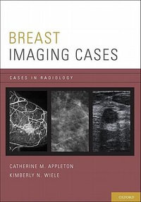 Breast Imaging Cases : Cases in Radiology - Catherine M. Appleton