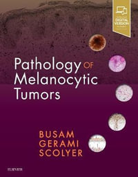 Pathology of Melanocytic Tumors - Klaus Busam