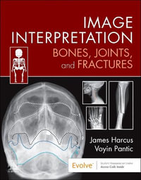 Image Interpretation : Bones, Joints, and Fractures - James Harcus