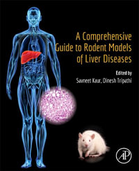 A Comprehensive Guide to Rodent Models of Liver Diseases - Savneet Kaur