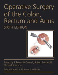 Operative Surgery of the Colon, Rectum and Anus - P Ronan O'Connell