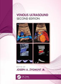 Venous Ultrasound - Joseph A. Zygmunt Jr.