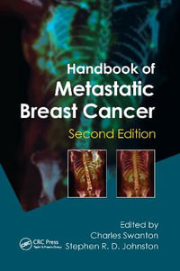 Handbook of Metastatic Breast Cancer - Charles Swanton