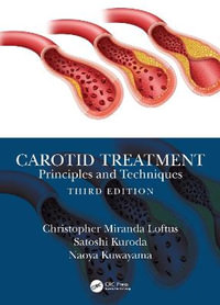 Carotid Treatment : Principles and Techniques - Christopher Miranda Loftus