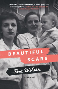 Beautiful Scars : Steeltown Secrets, Mohawk Skywalkers and the Road Home - Tom Wilson