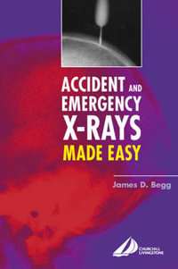 Accident and Emergency X-rays Made Easy : Made Easy - James D. Begg