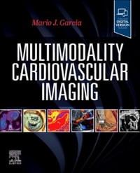 Multimodality Cardiovascular Imaging - Mario J. Garcia