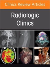 Current Controversies in Diagnostic and Interventional Radiology, An Issue of Radiologic Clinics of North America : Volume 62-6 - Douglas S. Katz