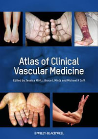 Atlas of Clinical Vascular Medicine - Michael R. Jaff