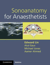 Sonoanatomy for Anaesthetists : Cambridge Medicine (Paperback) - Edward Lin