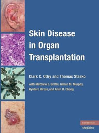 Skin Disease in Organ Transplantation - Clark C. Otley