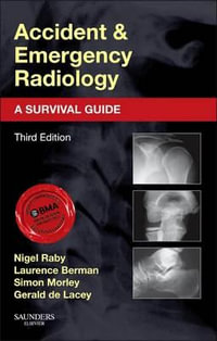 Accident and Emergency Radiology : 3rd Edition - A Survival Guide - Nigel Raby