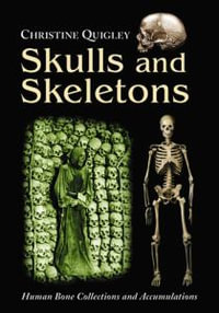 Skulls and Skeletons : Human Bone Collections and Accumulations - Christine Quigley