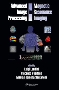 Advanced Image Processing in Magnetic Resonance Imaging : Signal Processing and Communications - Luigi  Landini