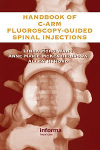 The Handbook of C-Arm Fluoroscopy-Guided Spinal Injections - Linda Hong Wang