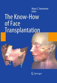 The Know-How of Face Transplantation - Maria Z. Siemionow