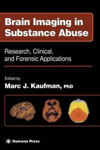 Brain Imaging in Substance Abuse : Research, Clinical, and Forensic Applications - Marc J. Kaufman