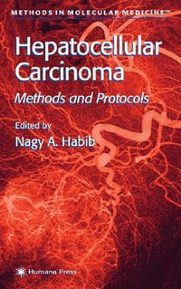 Hepatocellular Carcinoma : Methods and Protocols - Nagy A. Habib