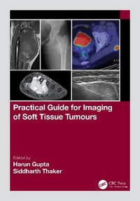 Practical Guide for Imaging of Soft Tissue Tumours - Harun Gupta