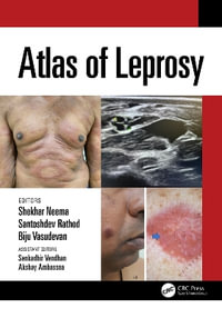 Atlas of Leprosy - Biju Vasudevan