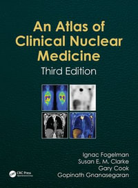 Atlas of Clinical Nuclear Medicine - Ignac Fogelman