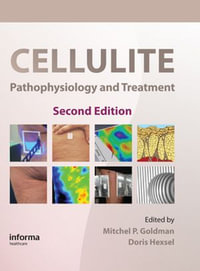 Cellulite : Pathophysiology and Treatment - Mitchel P. Goldman