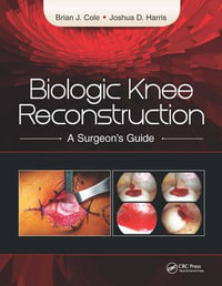 Biologic Knee Reconstruction : A Surgeon's Guide - Brian Cole