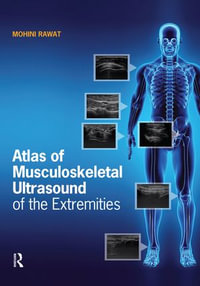 Atlas of Musculoskeletal Ultrasound of the Extremities - Mohini Rawat