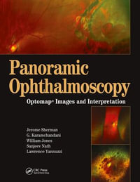 Panoramic Ophthalmoscopy : Optomap Images and Interpretation - Jerry Sherman