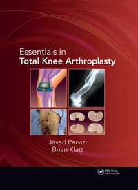 Essentials in Total Knee Arthroplasty - Javad Parvizi