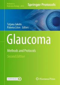 Glaucoma : Methods and Protocols - Tatjana Jakobs