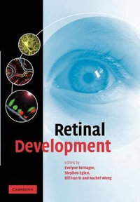 Retinal Development - Evelyne Sernagor