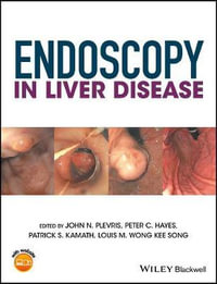 Endoscopy in Liver Disease - John N. Plevris