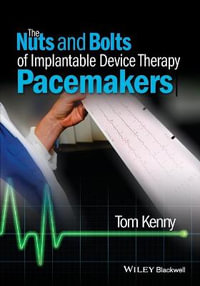 The Nuts and Bolts of Implantable Device Therapy : Pacemakers - Tom Kenny