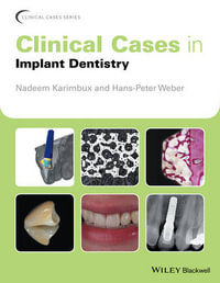 Clinical Cases in Implant Dentistry : Clinical Cases (Dentistry) - Nadeem Karimbux