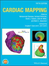 Cardiac Mapping - Mohammad Shenasa
