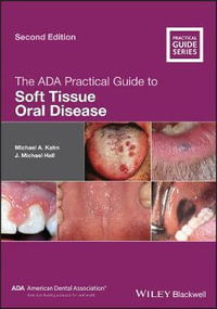 The ADA Practical Guide to Soft Tissue Oral Disease : ADA Practical Guide - Michael A. Kahn