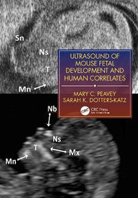 Ultrasound of Mouse Fetal Development and Human Correlates : Reproductive Medicine and Assisted Reproductive Techniques Series - Mary C. Peavey