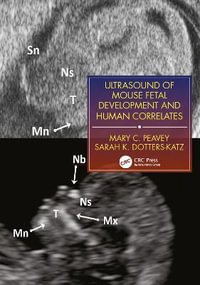 Ultrasound of Mouse Fetal Development and Human Correlates : Reproductive Medicine and Assisted Reproductive Techniques Series - Mary C. Peavey