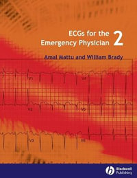 ECGs for the Emergency Physician 2 - Amal Mattu