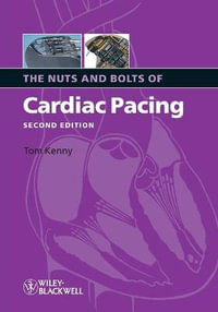 The Nuts and Bolts of Cardiac Pacing : Nuts and Bolts Series (Replaced by 5113) - Tom Kenny