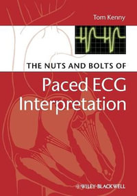 The Nuts and bolts of Paced ECG Interpretation : Nuts and Bolts Series (Replaced by 5113) - Tom Kenny