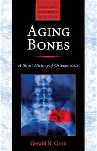 Aging Bones : A Short History of Osteoporosis - Gerald N. Grob